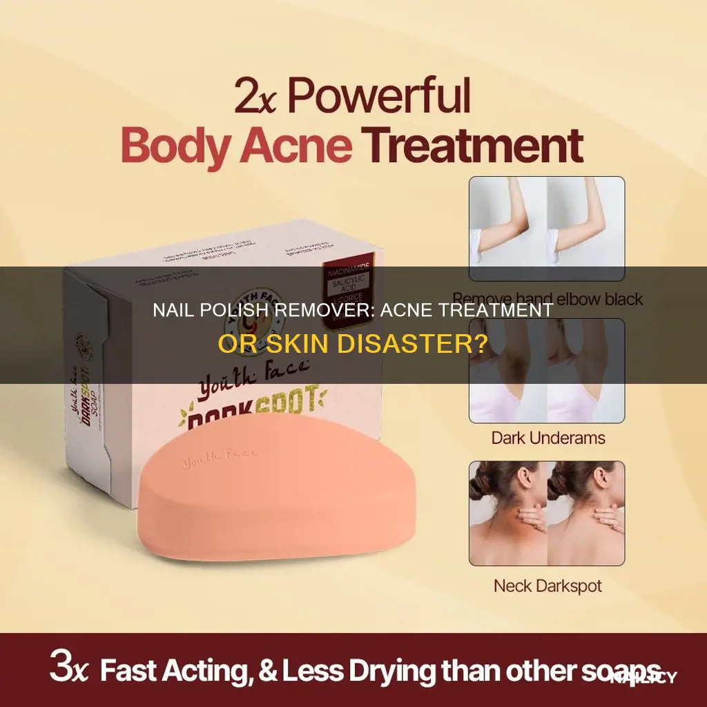 does nail polish remover help acne