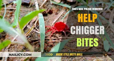 Nail Polish Remover: A Chigger Bite Treatment?