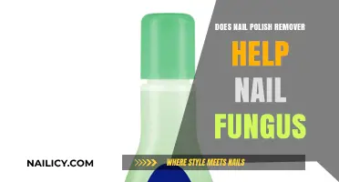 Nail Polish Remover: A Nail Fungus Treatment?