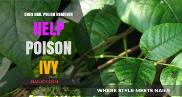Nail Polish Remover: A Poison Ivy Treatment?