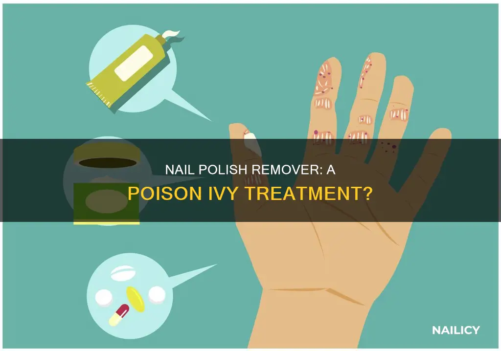 does nail polish remover help poison ivy