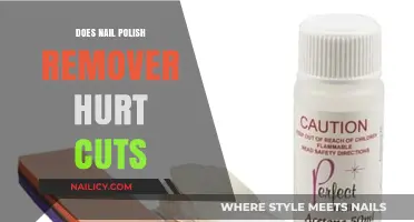 Nail Polish Remover: First Aid Friend or Foe?
