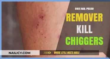 How Nail Polish Remover Can Kill Chiggers