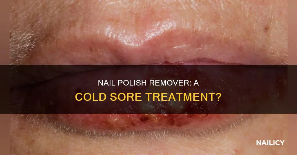 does nail polish remover work on cold sores