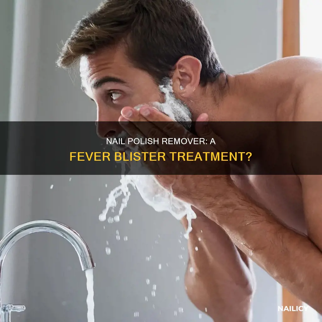 does nail polish remover work on fever blisters