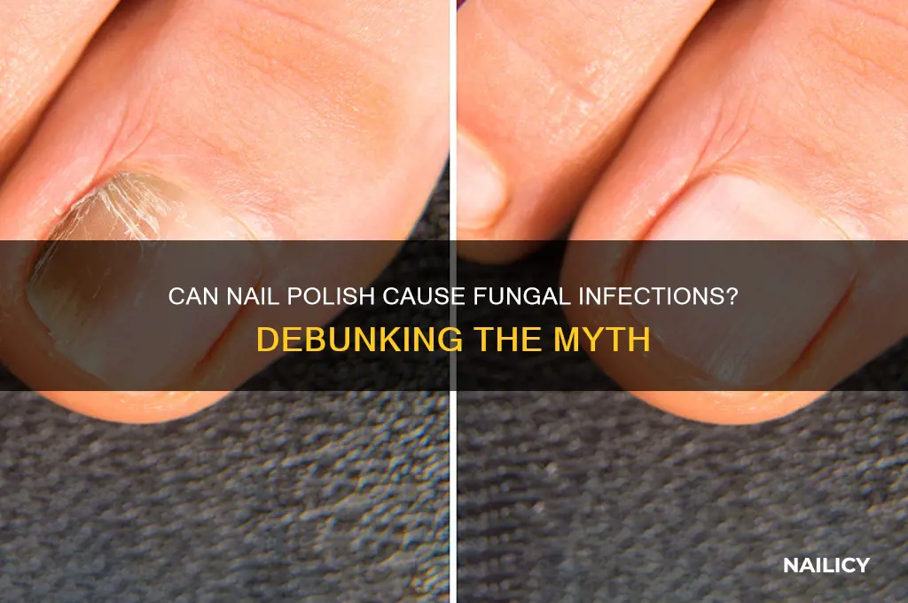 does nail polish spread fungus