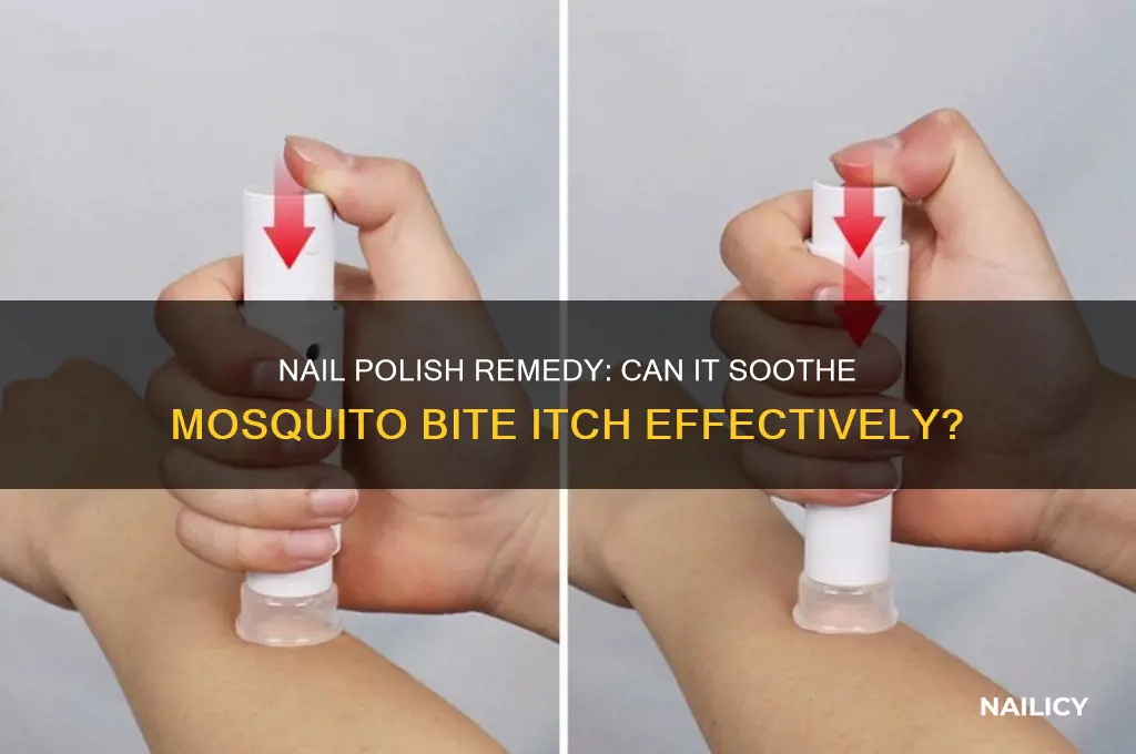 does nail polish stop mosquito bites from itching