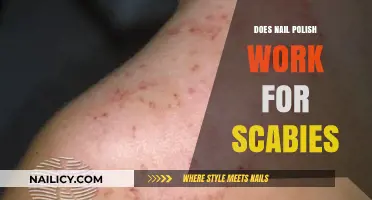 Nail Polish for Scabies: Effective Treatment or Myth?