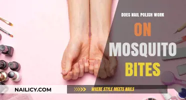 Nail Polish on Mosquito Bites: Effective Remedy or Myth?