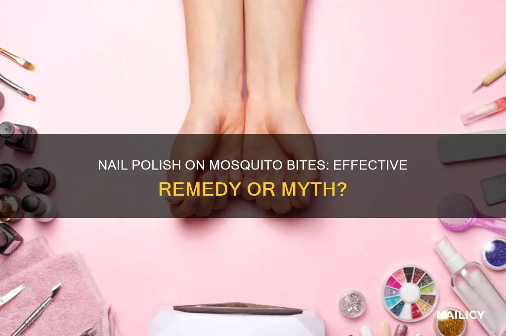 does nail polish work on mosquito bites