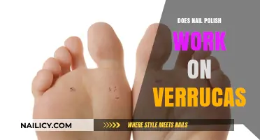 Can Nail Polish Effectively Treat Verrucas? A Comprehensive Guide