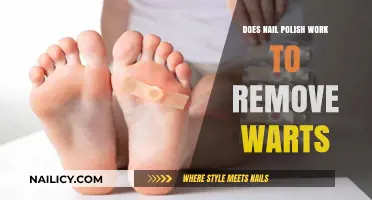 Nail Polish: A Simple Solution for Wart Removal?