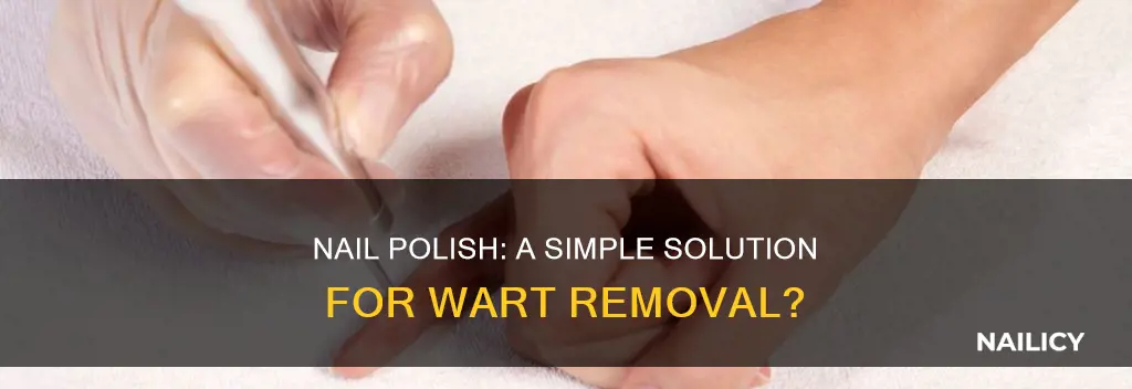 does nail polish work to remove warts