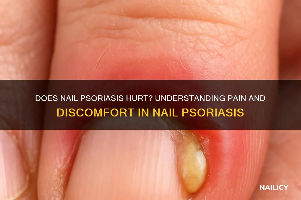 does nail psoriasis hurt