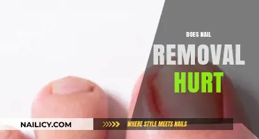 Nail Removal: Is It Painful?