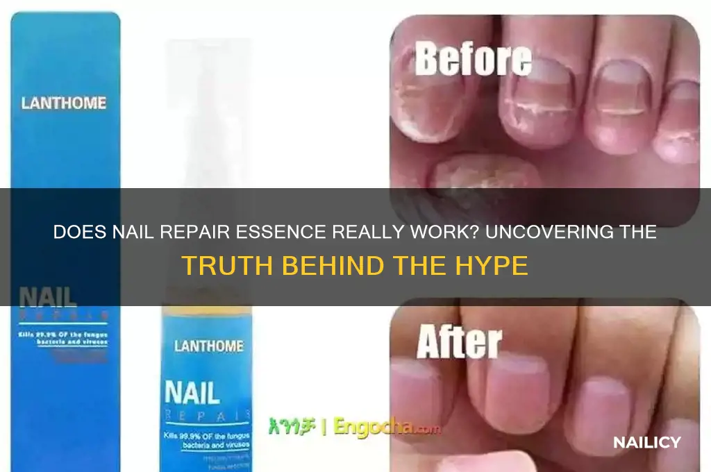 does nail repair essence work