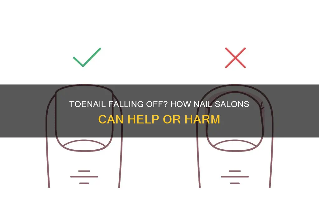 does nail salon care toenail falling off