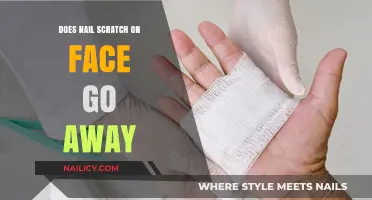 Nail Scratch on Face: Healing Time and Scar Prevention Tips