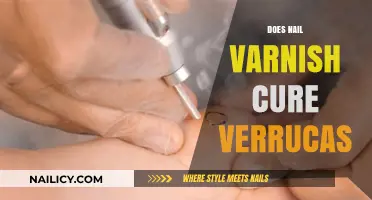 Nail Varnish for Verrucas: Myth or Effective Home Remedy?