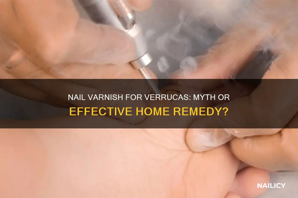 does nail varnish cure verrucas