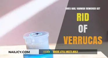 Debunking Myths: Can Nail Varnish Remover Really Cure Verrucas?