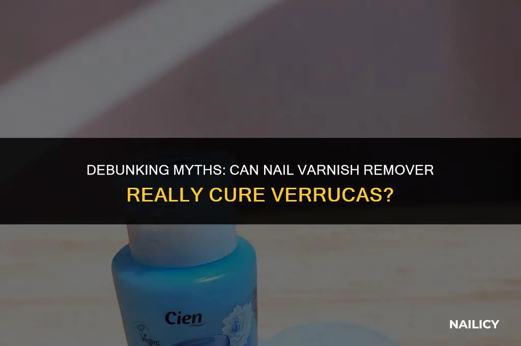 does nail varnish remover get rid of verrucas