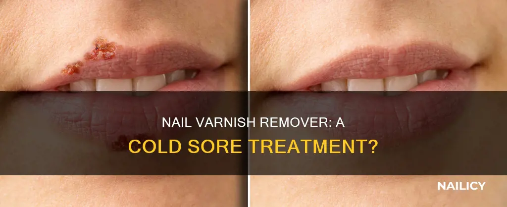 does nail varnish remover help cold sores