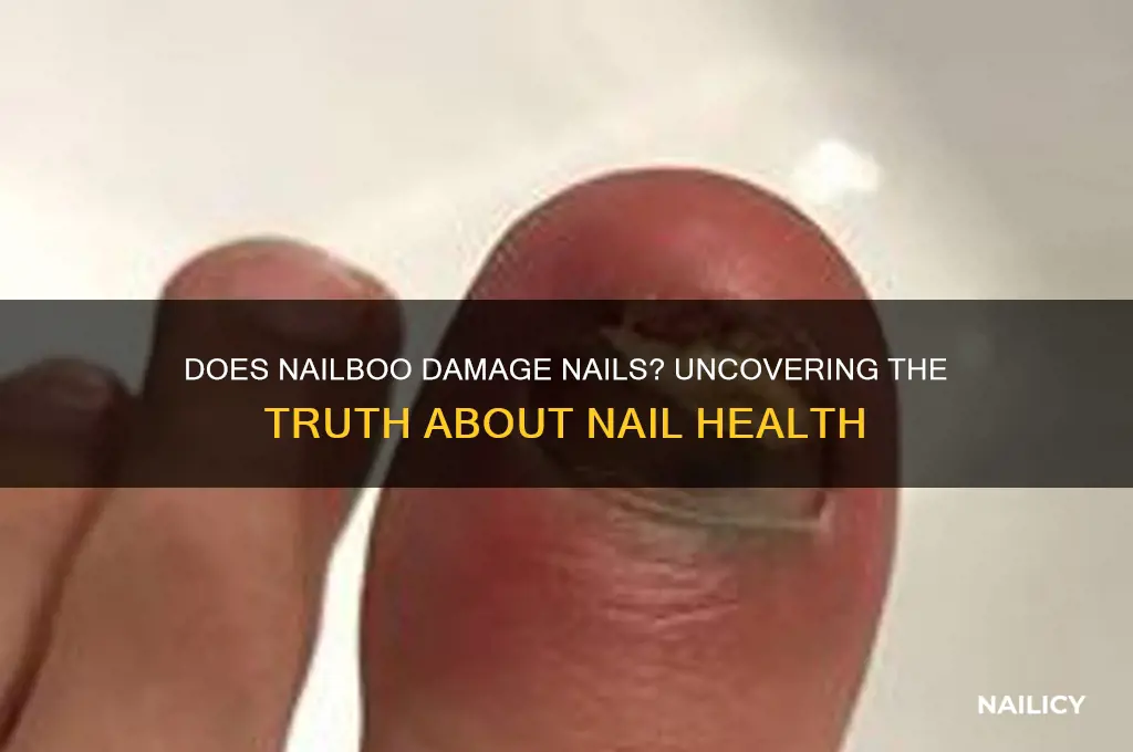 does nailboo damage nails