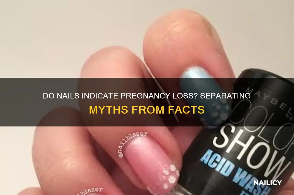 does nails lose the baby
