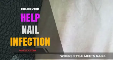 Neosporin for Nail Infections: Effective Treatment or Myth?