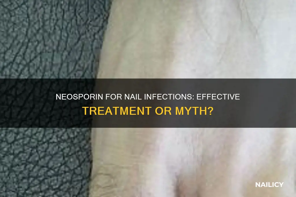 does neosporin help nail infection