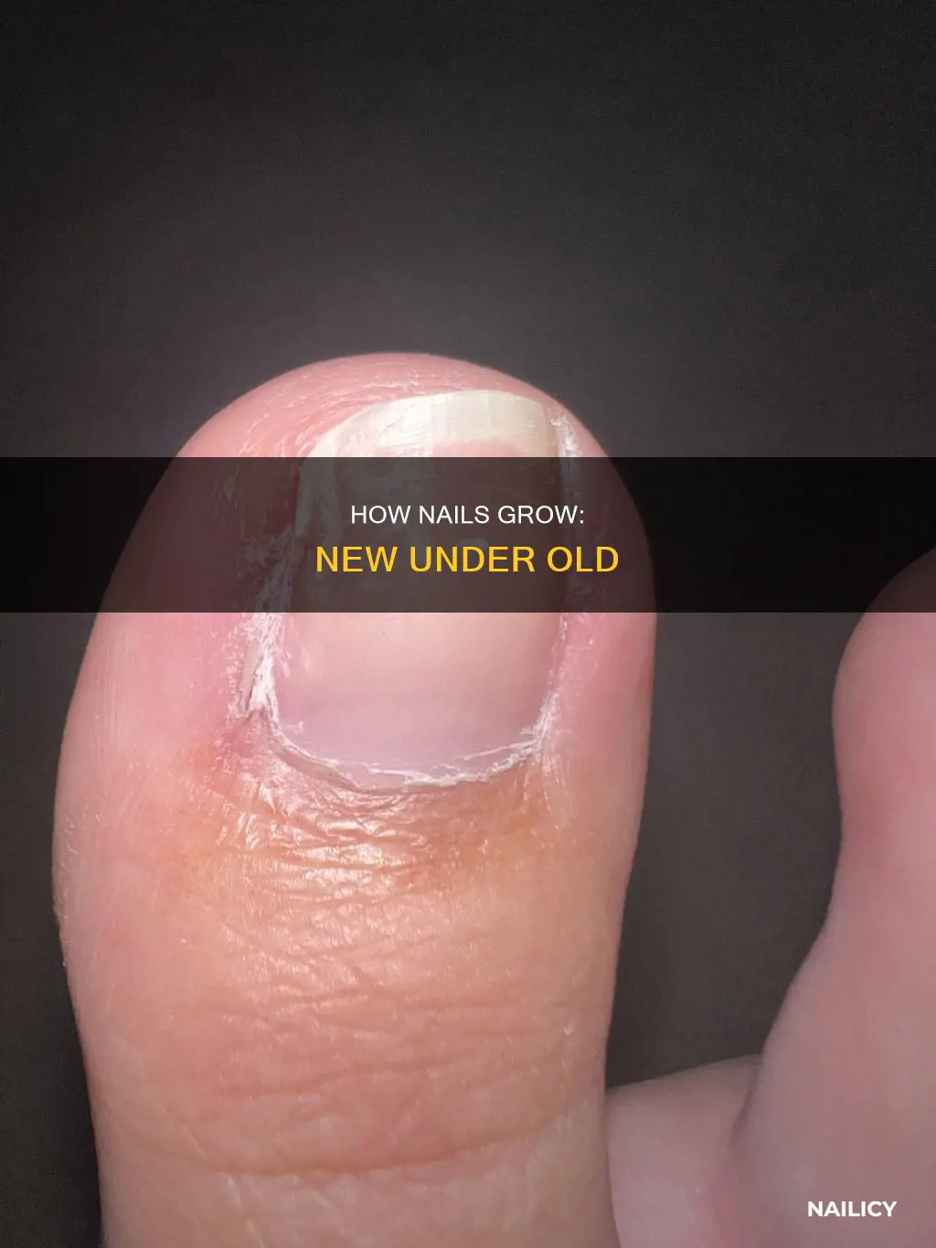 does new nail growing under old