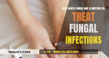 NonyX Gel: Effective Treatment for Fungal Nail Infections?