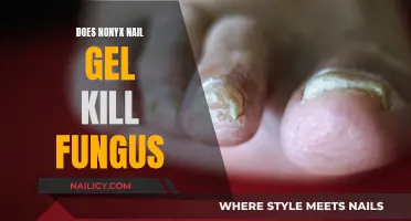 NonyX Nail Gel: Effective Treatment for Fungal Nails?