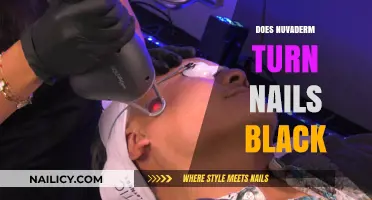 Nuvaderm and Nail Discoloration: Does It Turn Nails Black?