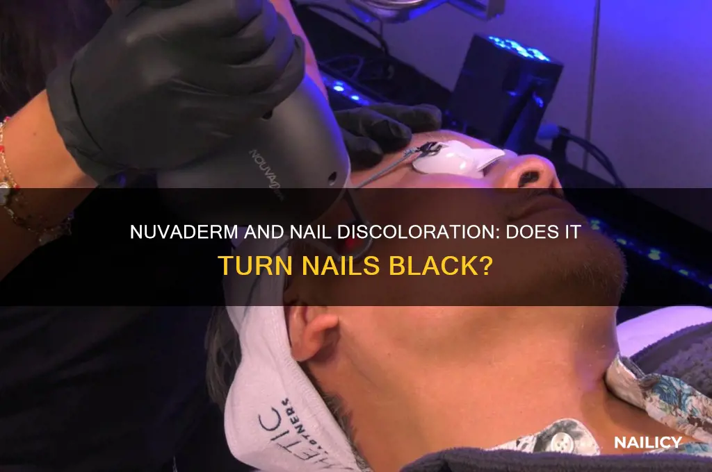 does nuvaderm turn nails black