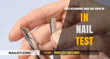 Exploring the Limits: Can Nail Tests Detect Occasional Drug Use?