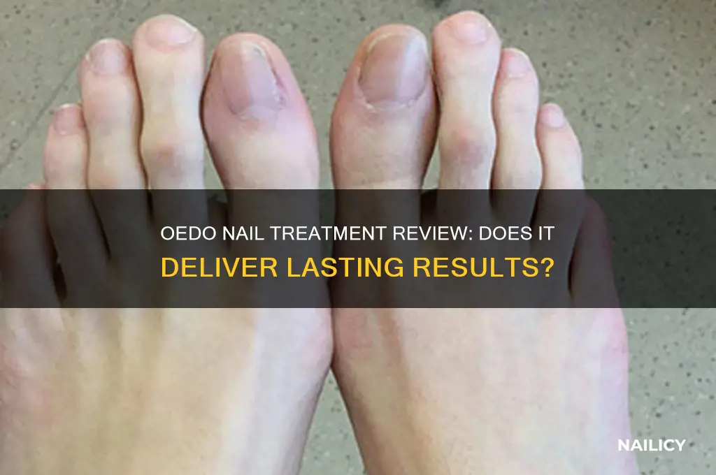 does oedo nail treatment work