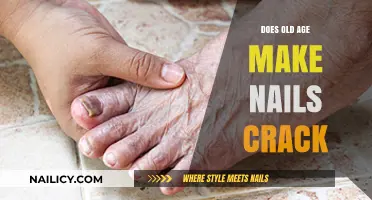 Aging Nails: Why They Crack and What to Do