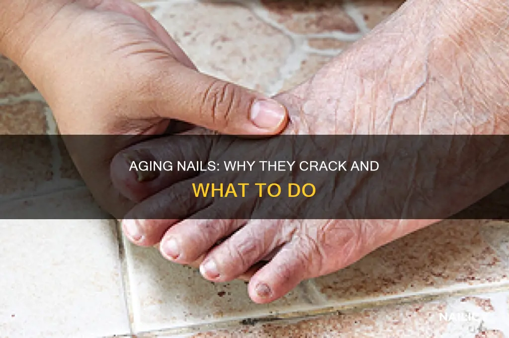 does old age make nails crack