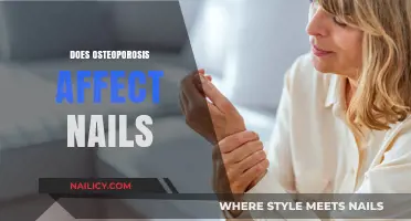 Osteoporosis and Nail Health: Uncovering the Surprising Connection