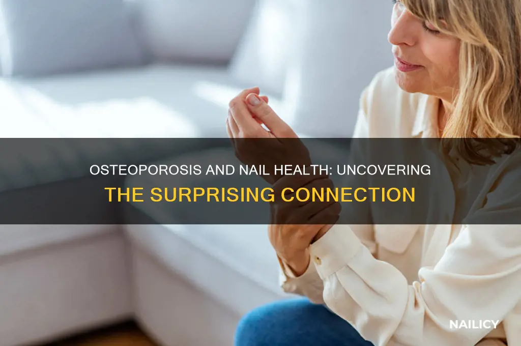 does osteoporosis affect nails