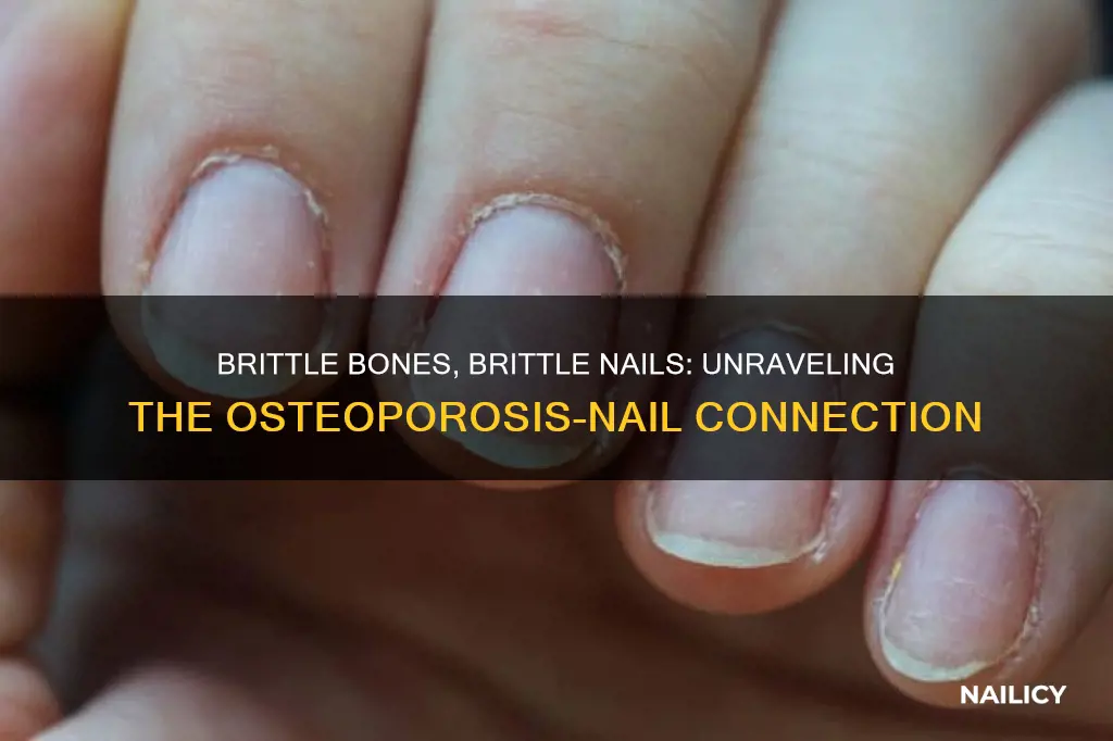 does osteoporosis cause finger nails to be brittle