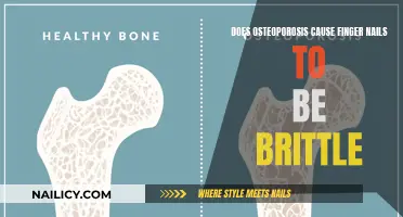 Osteoporosis and Nail Health: Is There a Connection?