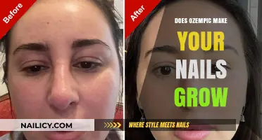 Ozempic's Surprising Side Effect: Nail Growth