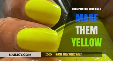 Nail Discoloration: Why Do Painted Nails Turn Yellow?