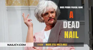 Pedro Pascal's Nail Mystery: Dead or Alive?