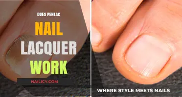 Penlac Nail Lacquer: Effectiveness, Results, and User Experiences Explored