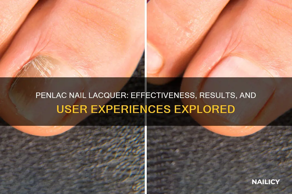 does penlac nail lacquer work