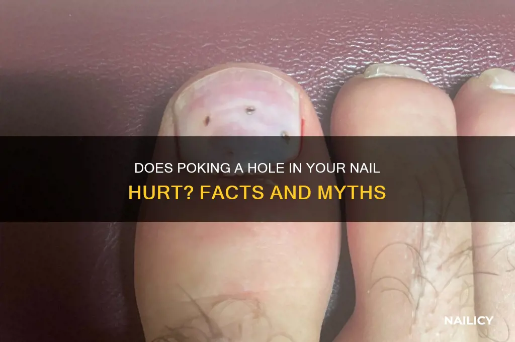 does poking a hole in your nail hurt